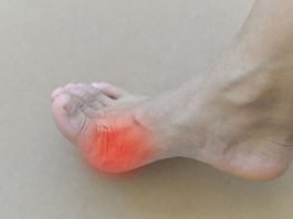 맥주 아니면 마셔도 괜찮다? 통풍에 관한 오해와 진실