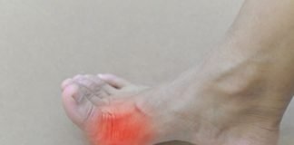 맥주 아니면 마셔도 괜찮다? 통풍에 관한 오해와 진실