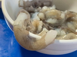 세발낙지는 다리가 셋이다?