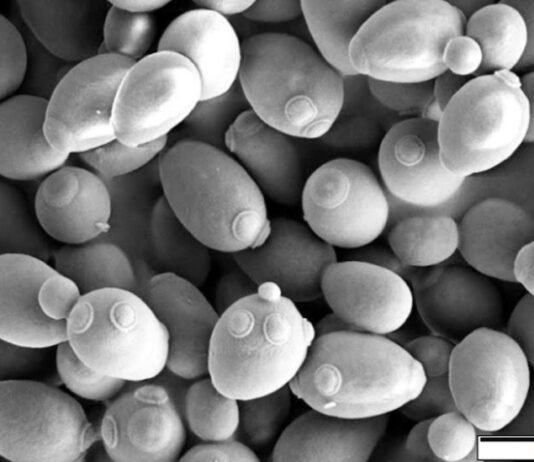 증류주와 위스키